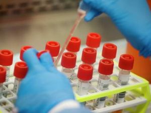 В Якутии за сутки выявлен 41 пациент с COVID-19