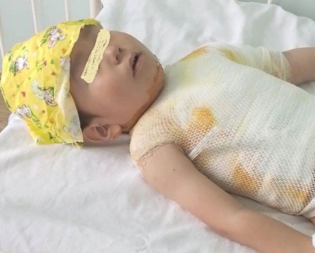 Мама мальчика, которого подожгли на детской площадке: "Я пойду до конца!"