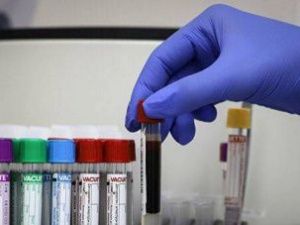 В Якутии приостановили работу рудника «АЛРОСА» из-за коронавируса