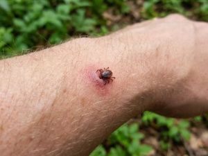 В Якутии зарегистрировано 532 случая укуса клещами