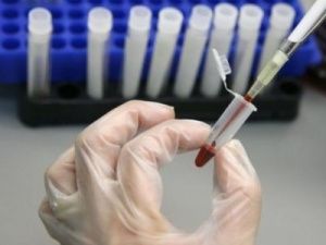 В Якутии сдали анализы на онкомаркеры 5066 человек