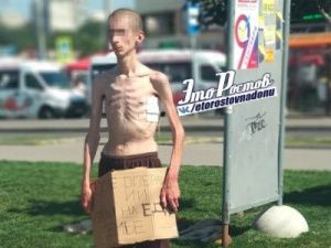 История «человека-скелета» из Якутии взволновала ростовчан (видео)