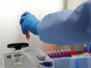 Минздрав Якутии ответил на часто задаваемые вопросы насчет анализов на COVID-19