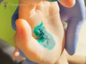 В 203-м микрорайоне Якутска девочка лишилась части пальца на игровой площадке: Суд взыскал с управляющей компании 500 тысяч рублей