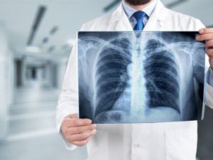 ЯГБ-2 проводит выездное флюорографическое обследование