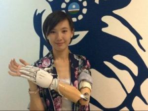 Якутские изобретатели разработали роботизированный протез кисти руки