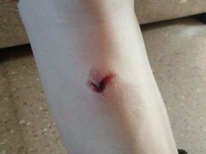 Школьник стал жертвой нападения собаки в Горном районе Якутии