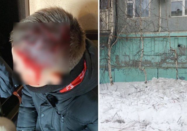 4 шва у ребенка: штраф 40.000