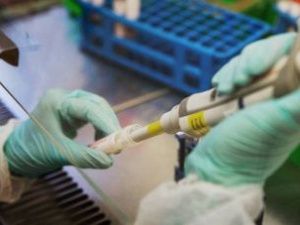 Минздрав Монголии сообщил о смерти 15-летнего подростка от чумы