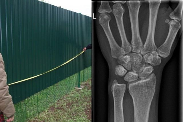 Житель Якутска сломал руку соседу за демонтаж его забора