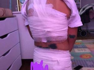 В Вилюйске на 4-летнюю девочку напали собаки. Прокуратура начала проверку