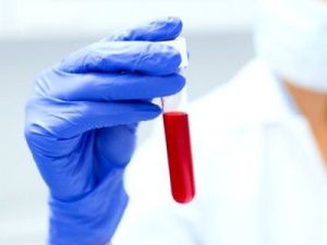 По сообщениям СМИ о заболевании детей коронавирусной инфекцией в летнем лагере организована процессуальная проверка