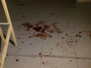 Фотофакт: В Якутске подъезд залит кровью