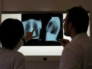 Якутянину на почве ревности сломали ребро