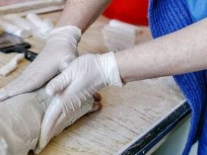 В Якутии после укусов собак в травмпункт обратились более 1000 человек за полгода