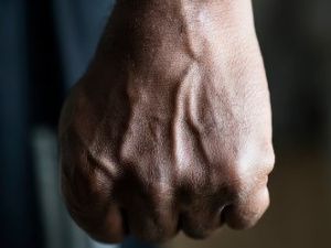 В одном из ночных клубов Якутска молодой человек сломал челюсть обидчику своей знакомой