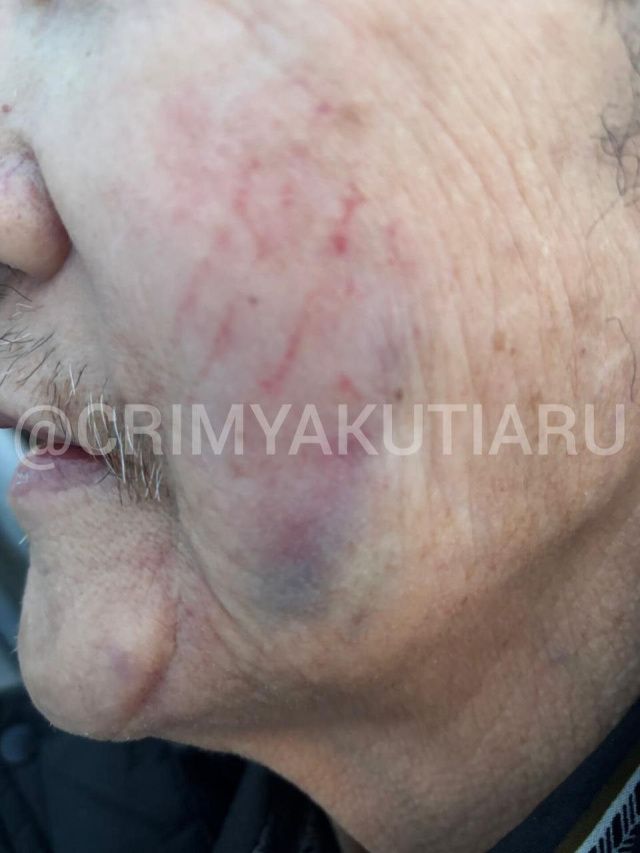 В Якутске неизвестный ворвался в квартиру пожилого человека, избил его и ограбил