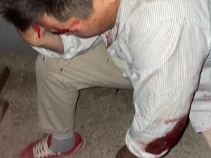 Полиция Якутска прокомментировала нападение вооруженной толпы на молодую пару 