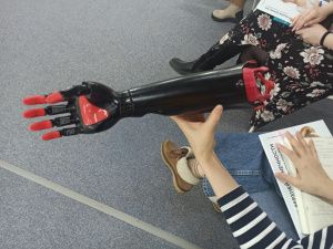 В Якутии продолжается реабилитация людей с ограниченными возможностями с помощью бионических протезов рук