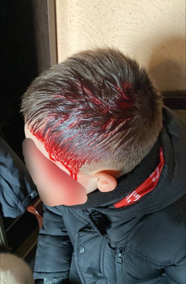 Лишь по счастливой случайности удалось избежать трагедии