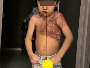 Родители школьника-пиромана просят уменьшить выплату морального вреда в размере трех миллионов