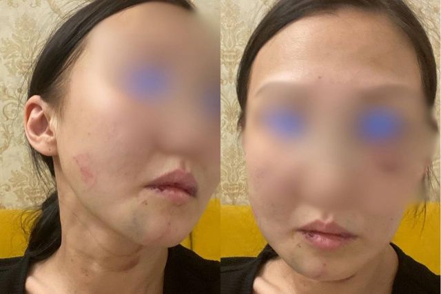 Жуткая история: И врагу не пожелаешь!