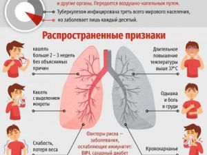 Что нужно знать о туберкулёзе?