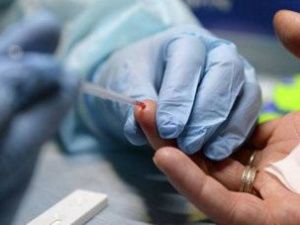 В Якутске пройдет анонимное тестирование на ВИЧ и гепатиты