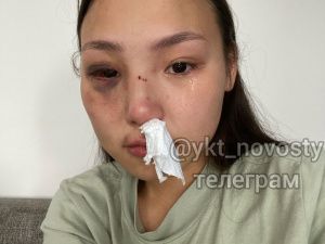 Якутянка обвинила сотрудника МЧС в избиении и домогательствах