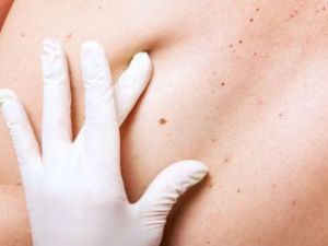 Тревожные знаки: названы основные симптомы рака