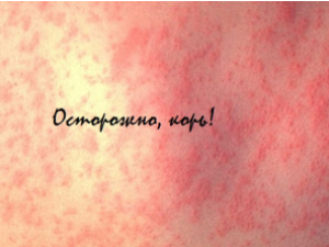 Летучий вирус. Что мы о нем знаем?