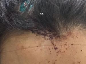 Гость ресторана «Новый Пекин»: «Администратор кинула в меня чем-то тяжелым, у меня пошла кровь»  