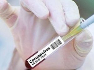 В Якутске в частном пансионате выявили 9 случаев коронавируса. Дело передано в суд