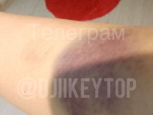 Жительница Якутска получила ушибы из-за врезавшегося в нее электросамокатчика: Горожанка просит запретить этот вид транспорта