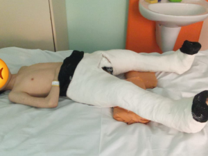 Мальчику сломали ноги, родители остались без поддержки