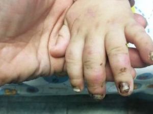 В Якутске избитый малыш помещен в Дом ребенка