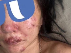 Замглавы Верхневилюйска жестоко избил мать своего ребенка