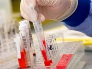 В Якутске пройдет акция по бесплатной диагностике диабета