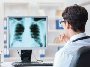 Врачи предупредили о требующем трансплантации легких последствии COVID-19