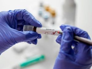 За сутки выявлено 48 новых случаев COVID-19