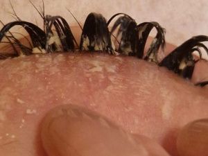 Не смогла открыть глаза: в Якутии девушка обратилась в больницу после наращивания ресниц