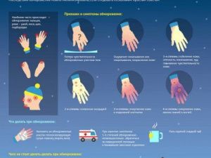 Минздрав Якутии напоминает о повышенном факторе травматизма зимой