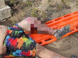 В Якутске парень попытался перелезть через забор и нaпopoлся нa мeтaлличecкий штыpь