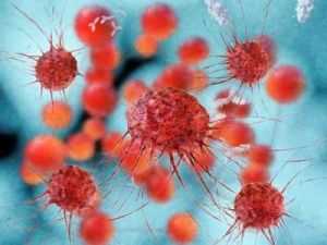 «Онкопоиск» запускает новое анкетирование