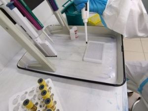 ПРОВЕРЬТЕ ВАШ РЕАЛЬНЫЙ COVID-ИММУНИТЕТ