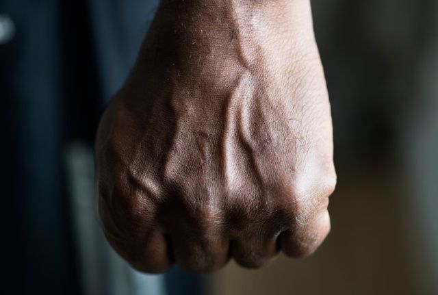 В Якутске вынесен приговор мужчине, который жестоко избил незнакомца и сломал ему кости черепа