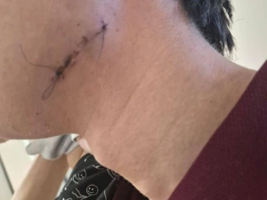 Студента поймали на остановке и избили в Якутске