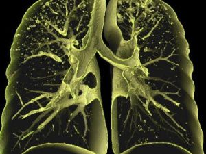 В исправительных учреждениях УФСИН по РС(Я) заболеваемость снизилась на 43,5 процента