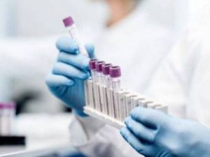 Еще у 59 жителей Якутии подтвердился коронавирус