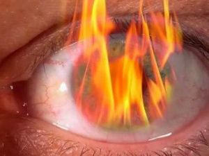 По сообщению СМИ о поражении учащихся Алданского политехнического техникума действием кварцевой лампы проводится процессуальная проверка